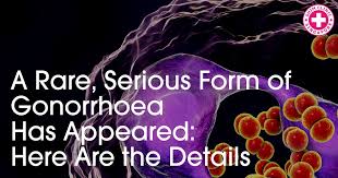 New antibiotic (vaccine) discovered to cure gonorrhoea